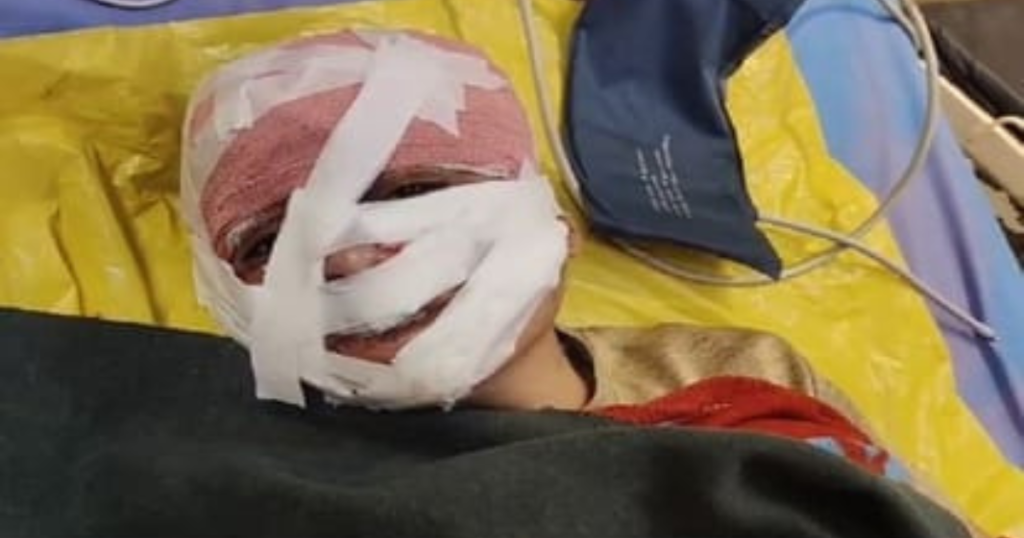 आगरा में भाभी के हमले में गंभीर रूप से घायल ननद अस्पताल में भर्ती