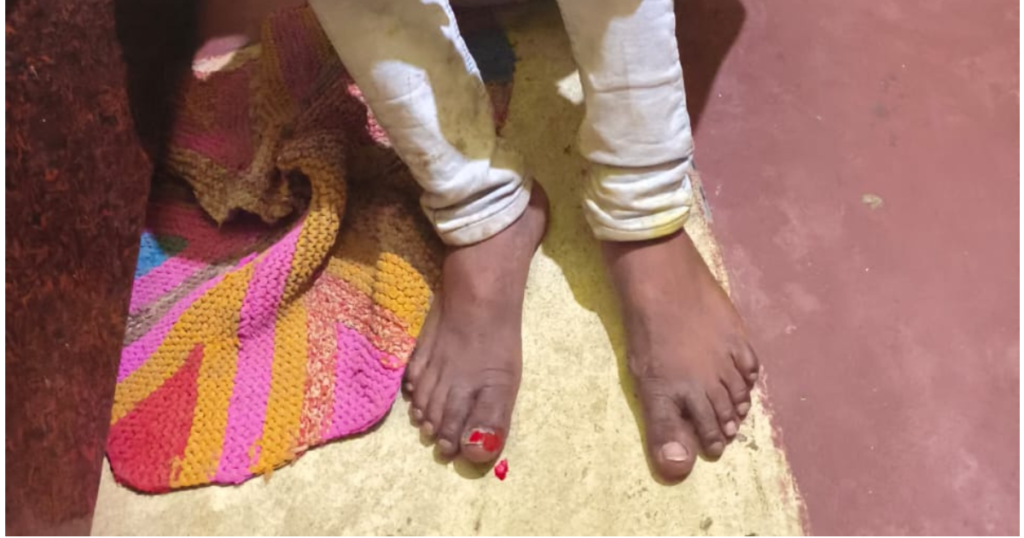 पुलिस पिटाई से घायल युवक आगरा 