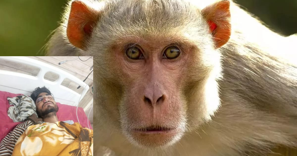 Agra News: आगरा में बंदरों के हमले में घायल छात्र अस्पताल में भर्ती